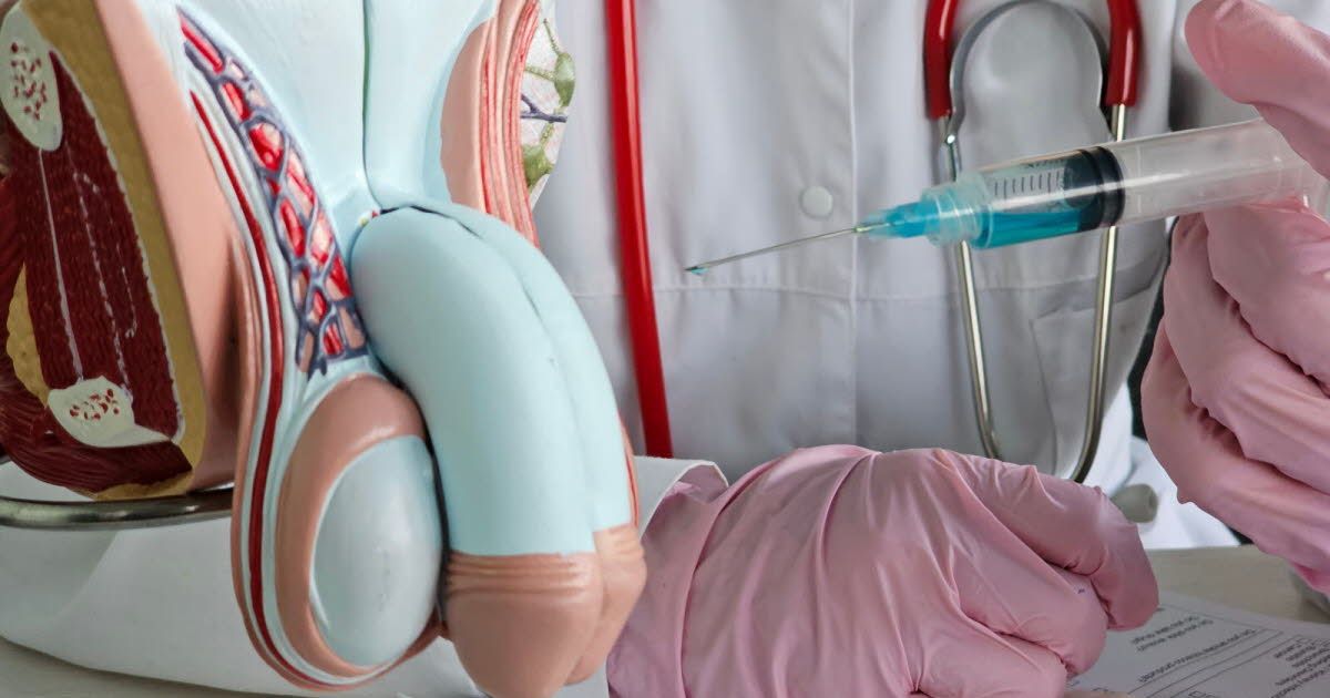 L'agrandissement du pénis : enjeux médicaux et techniques controversées
